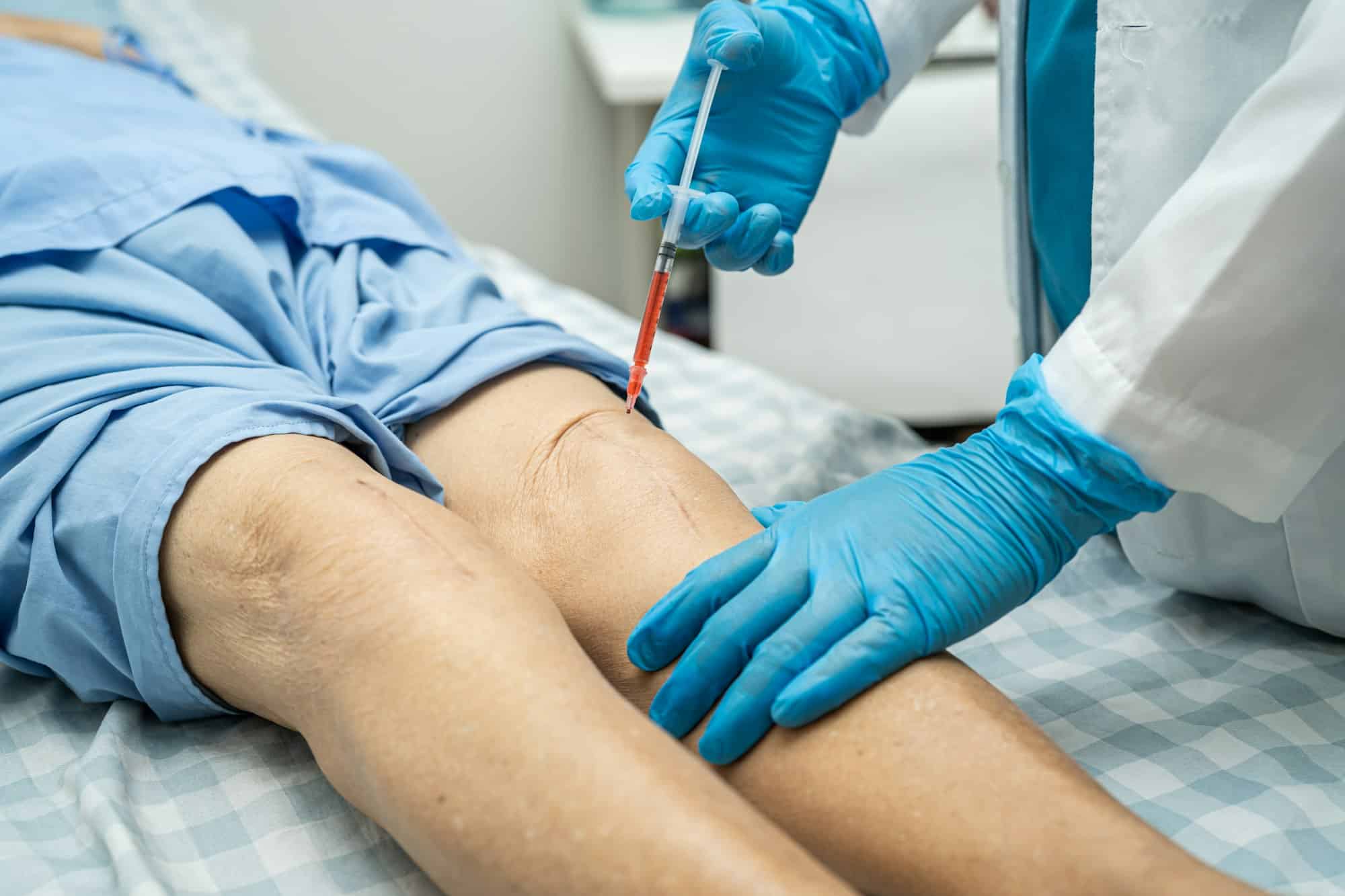 Asian doctor inject Hyaluronic acid platelet rich plasma into the knee of senior woman