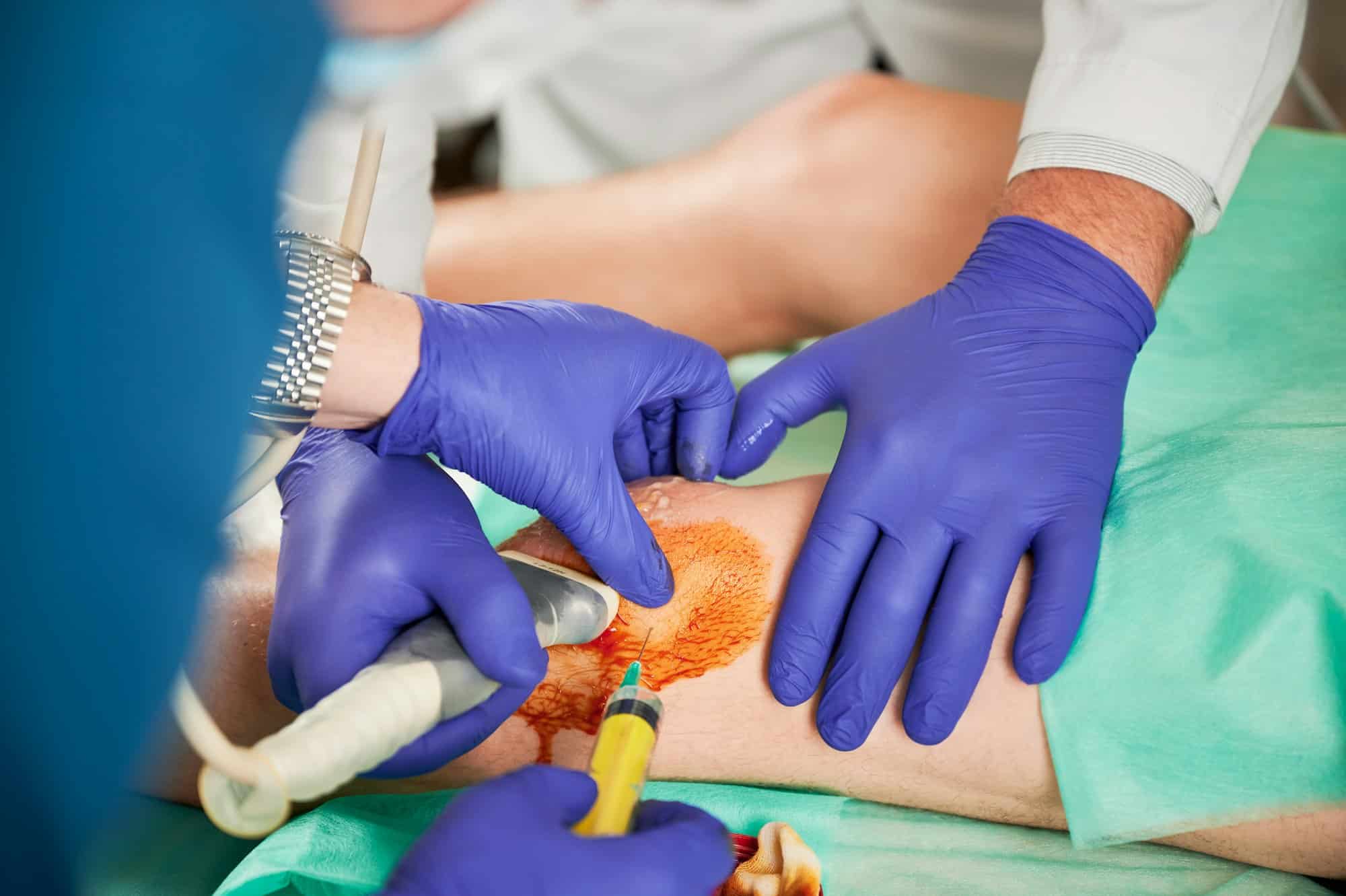 Doctor and nurse making injection in knee.