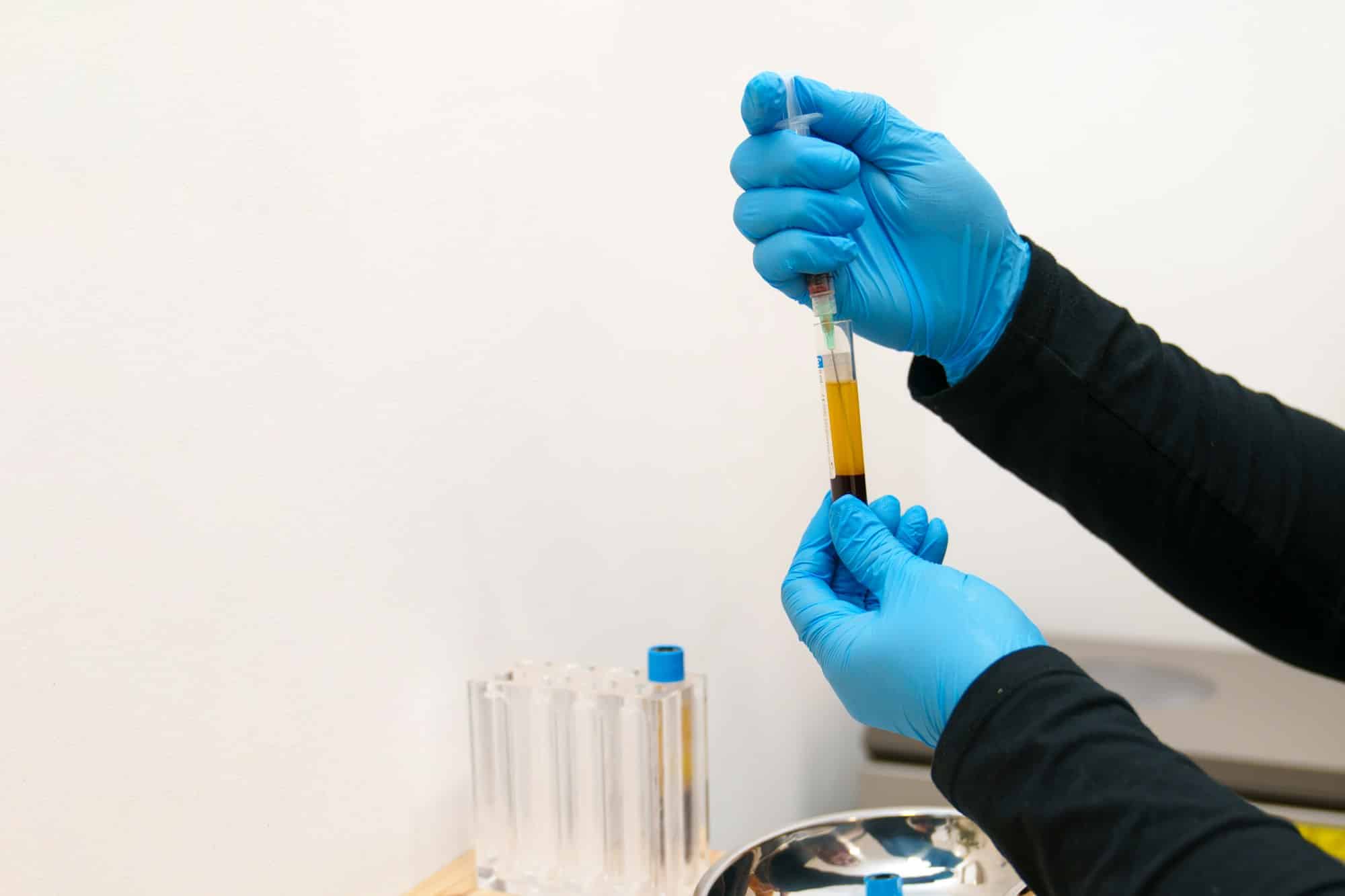 Medical Professional Preparing Blood Sample for PRP Treatment
